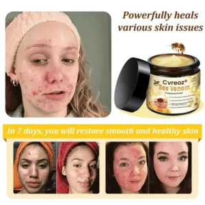 🌟 Official Store | Cvreoz® Bee Venom Skin Treatment Cream🚀LAST DAY 80% OFF(Sagging Skin, Fine Lines, Loss of Firmness, Flat Bust, Drooping Hips, and More)