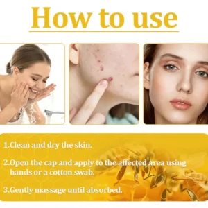 🌟 Official Store | Cvreoz® Bee Venom Skin Treatment Cream🚀LAST DAY 80% OFF(Sagging Skin, Fine Lines, Loss of Firmness, Flat Bust, Drooping Hips, and More)