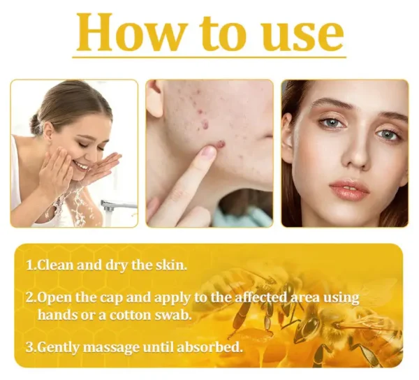 🌟 Official Store | Cvreoz® Bee Venom Skin Treatment Cream🚀LAST DAY 80% OFF(Sagging Skin, Fine Lines, Loss of Firmness, Flat Bust, Drooping Hips, and More)