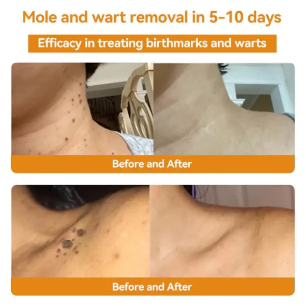 🌟 Official Store | Cvreoz® Bee Venom Skin Treatment Cream🚀LAST DAY 80% OFF(Sagging Skin, Fine Lines, Loss of Firmness, Flat Bust, Drooping Hips, and More)