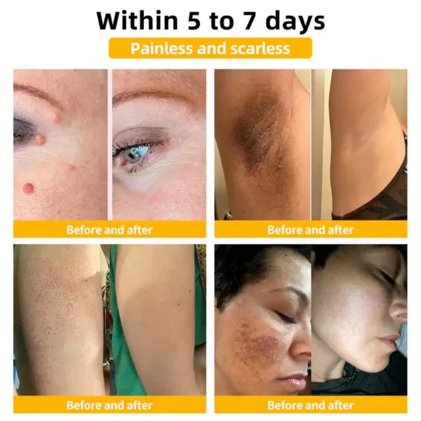 🌟 Official Store | Cvreoz® Bee Venom Skin Treatment Cream🚀LAST DAY 80% OFF(Sagging Skin, Fine Lines, Loss of Firmness, Flat Bust, Drooping Hips, and More)