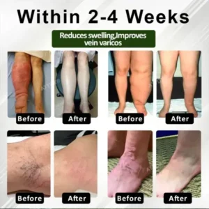 ATTDX® CircuHerb Edema Soothing & Healing Balm