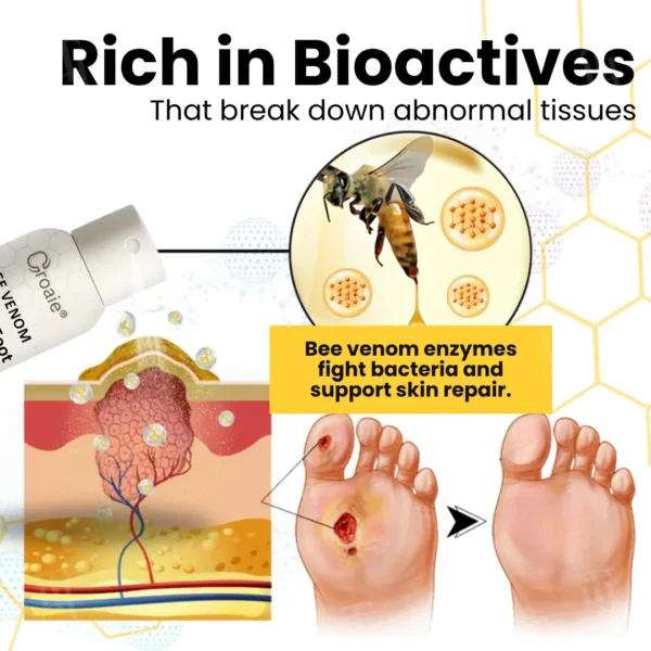 Croaie® Bee Venom Diabetic Foot Ulcer Spray ✅ 𝐕𝐢𝐬𝐢𝐛𝐥𝐞 𝐢𝐦𝐩𝐫𝐨𝐯𝐞𝐦𝐞𝐧𝐭 𝐢𝐧 𝟐-𝟑 𝐰𝐞𝐞𝐤𝐬✅