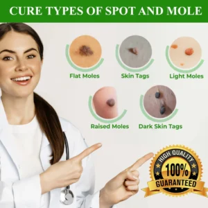 🔥HOT SALE: 60% OFF🔥Cvreoz® Natural Spot and Mole removal cream