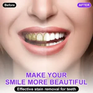 𝐅𝐥𝐲𝐬𝐦𝐮𝐬® 𝐂𝐨𝐥𝐨𝐮𝐫 𝐂𝐨𝐫𝐫𝐞𝐜𝐭𝐨𝐫 𝐒𝐞𝐫𝐮𝐦