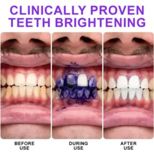 𝐅𝐥𝐲𝐬𝐦𝐮𝐬® 𝐂𝐨𝐥𝐨𝐮𝐫 𝐂𝐨𝐫𝐫𝐞𝐜𝐭𝐨𝐫 𝐒𝐞𝐫𝐮𝐦
