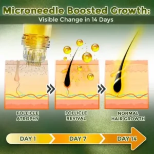 Flysmus® Microneedle Herbal Infusion Hair Stimulation Set