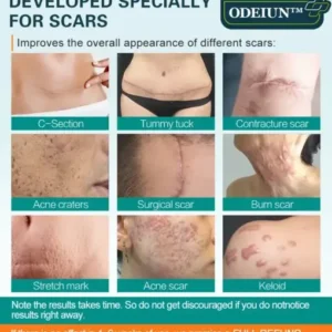 ODEIUN™ Advanced Scar Spray