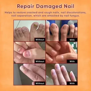 ODEIUN™ Nails Repair Serum
