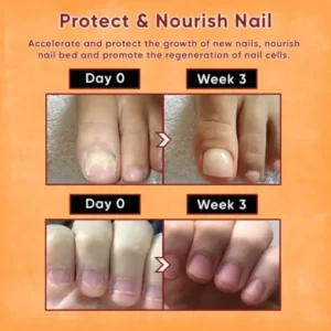 ODEIUN™ Nails Repair Serum