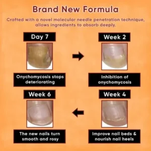 ODEIUN™ Nails Repair Serum