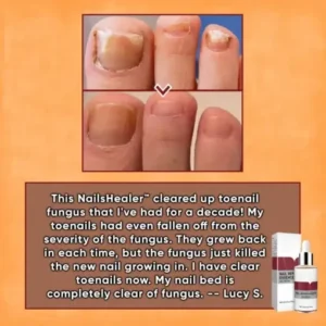 ODEIUN™ Nails Repair Serum