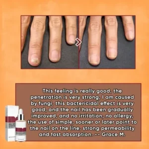 ODEIUN™ Nails Repair Serum