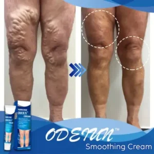 ODEIUN™ Smoothing Cream