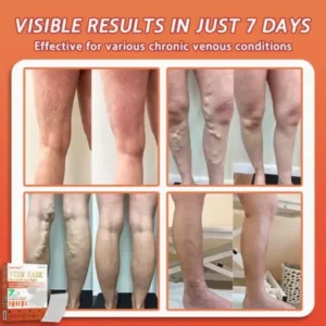 Seurico™ Vein Ease Microneedle Care Patch