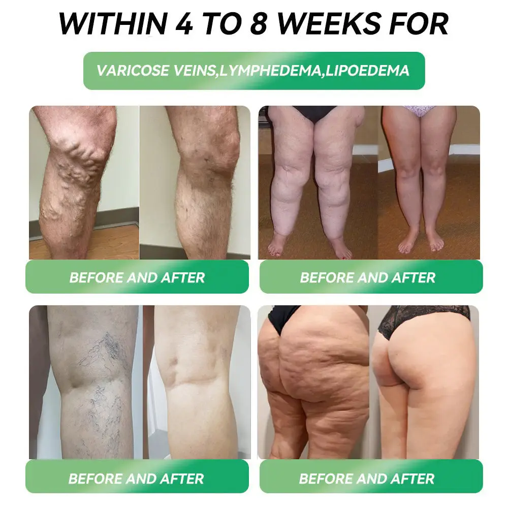 ๐พ๐๐ ๐๐ฃ๐ก๐๐ฃ๐ ๐๐๐๐ง๐ข๐๐๐ฎ| Official USA Store โ Croaieยฎ Telportide Oral Solution, GIP and GLP-1 Dual-Action Weight Loss Solution, One Bottle Daily, Results in 7 Days๐๏ธ