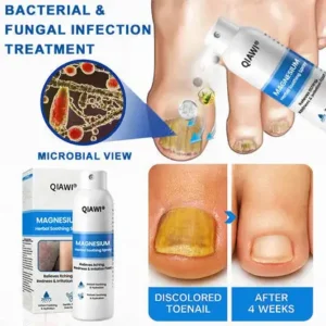 ✅ Official Store: QIAWI   Magnesium Herbal Psoriasis Spray 👨‍⚕️ MHRA Approved (Relieves psoriasis and eczema, improves bacterial infections in the genital area, treats acne and warts)