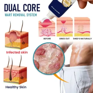 Alisanda™ |Genital Warts Remover Cream for Men