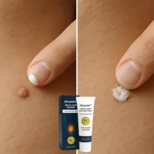 Alisanda™ |Genital Warts Remover Cream for Men
