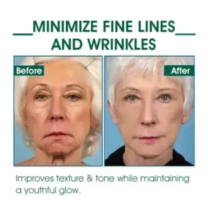 Alisanda™🔥👩‍⚕️Last Day Promotion 𝟕𝟎%𝐎𝐅𝐅 - SkinFirming Rejuvenating Serum🔥