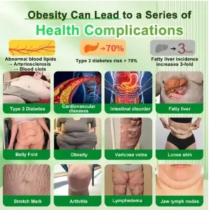 Croaie® 𝗚𝗟𝗣-𝟭 𝟐𝟎-𝐢𝐧-𝟏 𝐒𝐥𝐢𝐦& 𝑯𝒆𝒂𝒍𝒕𝒉𝐲 𝑶𝒓𝒂𝒍 𝑺𝒐𝒍𝒖𝒕𝒊𝒐𝒏