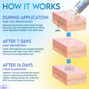 ✨ODEIUN™ HPV Genital Warts Relief Cream – Fast, Gentle & Private Care💪