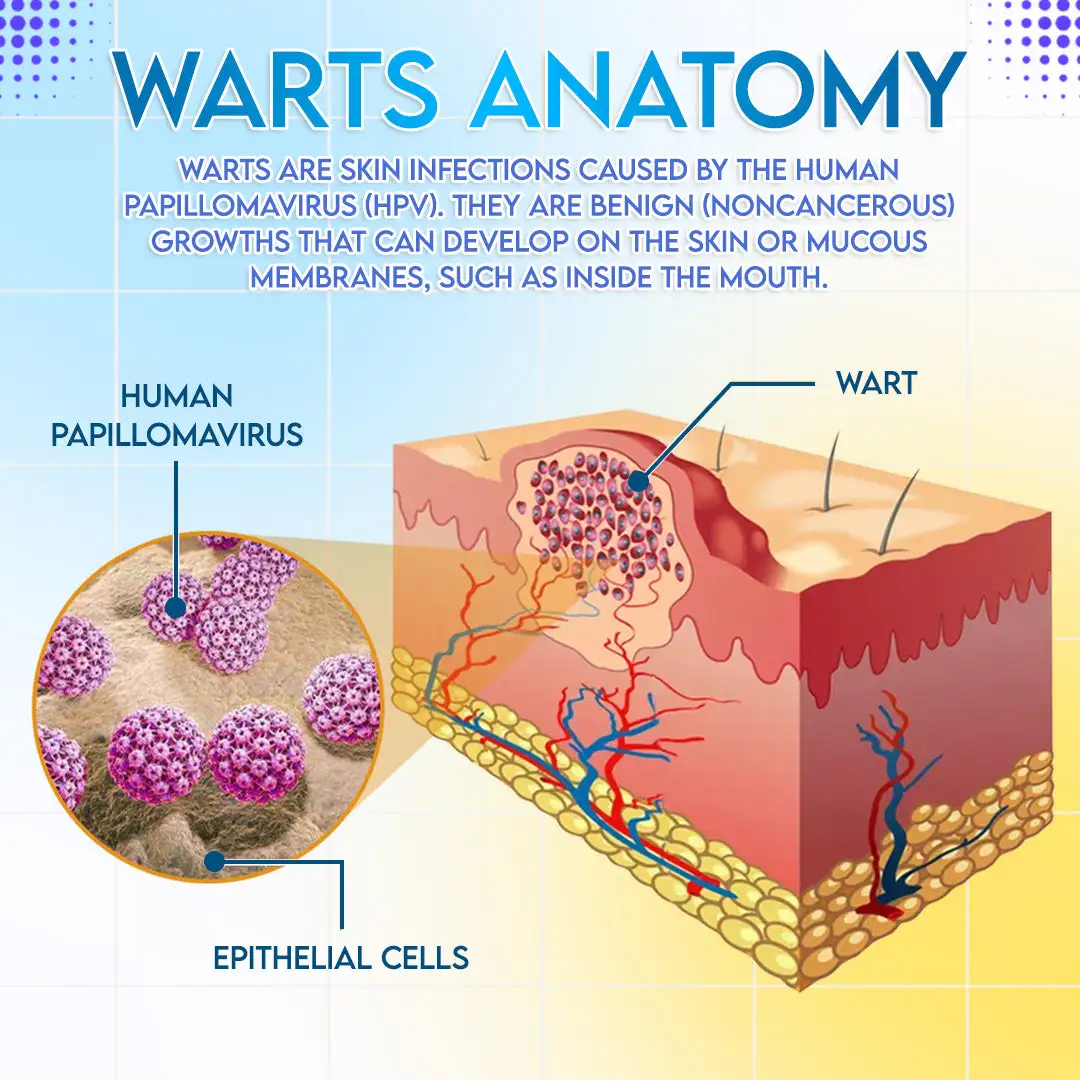 ✨ODEIUN™ HPV Genital Warts Relief Cream – Fast, Gentle & Private Care💪