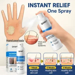 QIAWI Magnesium Herbal Psoriasis Spray