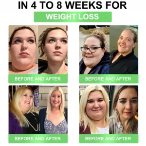 🇺🇸US Online丨Croaie® GLP-1 8-in-1 Oral Health Solution (just once daily, visible changes in 7 days) ✅ Suitable for obesity, cardiovascular health, diabetes, sleep apnea, gut health, joint issues, and more.