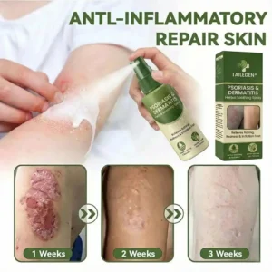 ๐ฅ๐๐ถ๐ป๐ฎ๐น ๐ฏ ๐๐ผ๐๐ฟ๐: ๐ด๐ฌ% ๐ข๐๐:๐ง๐๐๐๐๐๐๐กยฎ ๐ ๐ฎ๐ด๐ป๐ฒ๐๐ถ๐๐บ ๐๐ฒ๐ฟ๐ฏ๐ฎ๐น ๐ฃ๐๐ผ๐ฟ๐ถ๐ฎ๐๐ถ๐ ๐ฆ๐ฝ๐ฟ๐ฎ๐โ๏ธ ๐๐๐ ๐๐ฒ๐ฟ๐๐ถ๐ณ๐ถ๐ฒ๐ฑ (๐ณ๐ผ๐ฟ ๐๐ต๐ฒ ๐๐ฟ๐ฒ๐ฎ๐๐บ๐ฒ๐ป๐ ๐ผ๐ณ ๐ฝ๐๐ผ๐ฟ๐ถ๐ฎ๐๐ถ๐ ๐ฎ๐ป๐ฑ ๐ฒ๐ฐ๐๐ฒ๐บ๐ฎ, ๐ถ๐บ๐ฝ๐ฟ๐ผ๐๐ฒ๐บ๐ฒ๐ป๐ ๐ผ๐ณ ๐ฏ๐ฎ๐ฐ๐๐ฒ๐ฟ๐ถ๐ฎ๐น ๐ถ๐ป๐ณ๐ฒ๐ฐ๐๐ถ๐ผ๐ป๐ ๐ถ๐ป ๐๐ต๐ฒ ๐ด๐ฒ๐ป๐ถ๐๐ฎ๐น ๐ฎ๐ฟ๐ฒ๐ฎ, ๐๐ฟ๐ฒ๐ฎ๐๐บ๐ฒ๐ป๐ ๐ผ๐ณ ๐ฎ๐ฐ๐ป๐ฒ ๐ฎ๐ป๐ฑ ๐๐ฎ๐ฟ๐๐, ๐ฒ๐น๐ถ๐บ๐ถ๐ป๐ฎ๐๐ฒ๐ ๐ฝ๐๐ผ๐ฟ๐ถ๐ฎ๐๐ถ๐ ๐ฎ๐ป๐ฑ ๐ฒ๐ฐ๐๐ฒ๐บ๐ฎ, ๐ฒ๐๐ฐ.)