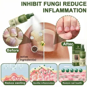 ๐ฅ๐๐ถ๐ป๐ฎ๐น ๐ฏ ๐๐ผ๐๐ฟ๐: ๐ด๐ฌ% ๐ข๐๐:๐ง๐๐๐๐๐๐๐กยฎ ๐ ๐ฎ๐ด๐ป๐ฒ๐๐ถ๐๐บ ๐๐ฒ๐ฟ๐ฏ๐ฎ๐น ๐ฃ๐๐ผ๐ฟ๐ถ๐ฎ๐๐ถ๐ ๐ฆ๐ฝ๐ฟ๐ฎ๐โ๏ธ ๐๐๐ ๐๐ฒ๐ฟ๐๐ถ๐ณ๐ถ๐ฒ๐ฑ (๐ณ๐ผ๐ฟ ๐๐ต๐ฒ ๐๐ฟ๐ฒ๐ฎ๐๐บ๐ฒ๐ป๐ ๐ผ๐ณ ๐ฝ๐๐ผ๐ฟ๐ถ๐ฎ๐๐ถ๐ ๐ฎ๐ป๐ฑ ๐ฒ๐ฐ๐๐ฒ๐บ๐ฎ, ๐ถ๐บ๐ฝ๐ฟ๐ผ๐๐ฒ๐บ๐ฒ๐ป๐ ๐ผ๐ณ ๐ฏ๐ฎ๐ฐ๐๐ฒ๐ฟ๐ถ๐ฎ๐น ๐ถ๐ป๐ณ๐ฒ๐ฐ๐๐ถ๐ผ๐ป๐ ๐ถ๐ป ๐๐ต๐ฒ ๐ด๐ฒ๐ป๐ถ๐๐ฎ๐น ๐ฎ๐ฟ๐ฒ๐ฎ, ๐๐ฟ๐ฒ๐ฎ๐๐บ๐ฒ๐ป๐ ๐ผ๐ณ ๐ฎ๐ฐ๐ป๐ฒ ๐ฎ๐ป๐ฑ ๐๐ฎ๐ฟ๐๐, ๐ฒ๐น๐ถ๐บ๐ถ๐ป๐ฎ๐๐ฒ๐ ๐ฝ๐๐ผ๐ฟ๐ถ๐ฎ๐๐ถ๐ ๐ฎ๐ป๐ฑ ๐ฒ๐ฐ๐๐ฒ๐บ๐ฎ, ๐ฒ๐๐ฐ.)