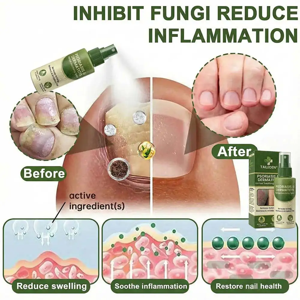 ๐ฅ๐๐ถ๐ป๐ฎ๐น ๐ฏ ๐๐ผ๐๐ฟ๐: ๐ด๐ฌ% ๐ข๐๐:๐ง๐๐๐๐๐๐๐กยฎ ๐ ๐ฎ๐ด๐ป๐ฒ๐๐ถ๐๐บ ๐๐ฒ๐ฟ๐ฏ๐ฎ๐น ๐ฃ๐๐ผ๐ฟ๐ถ๐ฎ๐๐ถ๐ ๐ฆ๐ฝ๐ฟ๐ฎ๐โ๏ธ ๐๐๐ ๐๐ฒ๐ฟ๐๐ถ๐ณ๐ถ๐ฒ๐ฑ (๐ณ๐ผ๐ฟ ๐๐ต๐ฒ ๐๐ฟ๐ฒ๐ฎ๐๐บ๐ฒ๐ป๐ ๐ผ๐ณ ๐ฝ๐๐ผ๐ฟ๐ถ๐ฎ๐๐ถ๐ ๐ฎ๐ป๐ฑ ๐ฒ๐ฐ๐๐ฒ๐บ๐ฎ, ๐ถ๐บ๐ฝ๐ฟ๐ผ๐๐ฒ๐บ๐ฒ๐ป๐ ๐ผ๐ณ ๐ฏ๐ฎ๐ฐ๐๐ฒ๐ฟ๐ถ๐ฎ๐น ๐ถ๐ป๐ณ๐ฒ๐ฐ๐๐ถ๐ผ๐ป๐ ๐ถ๐ป ๐๐ต๐ฒ ๐ด๐ฒ๐ป๐ถ๐๐ฎ๐น ๐ฎ๐ฟ๐ฒ๐ฎ, ๐๐ฟ๐ฒ๐ฎ๐๐บ๐ฒ๐ป๐ ๐ผ๐ณ ๐ฎ๐ฐ๐ป๐ฒ ๐ฎ๐ป๐ฑ ๐๐ฎ๐ฟ๐๐, ๐ฒ๐น๐ถ๐บ๐ถ๐ป๐ฎ๐๐ฒ๐ ๐ฝ๐๐ผ๐ฟ๐ถ๐ฎ๐๐ถ๐ ๐ฎ๐ป๐ฑ ๐ฒ๐ฐ๐๐ฒ๐บ๐ฎ, ๐ฒ๐๐ฐ.)