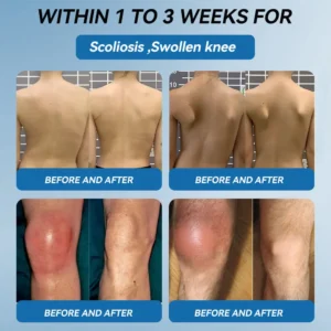 | 𝐋𝐚𝐬𝐭 𝐃𝐚𝐲 𝐏𝐫𝐨𝐦𝐨𝐭𝐢𝐨𝐧 𝟖𝟎% 𝐎𝐅𝐅 |  🇨🇦 Croaie® ʙ.ᴘ.ᴄ-157 Joint Healing Cream🦴Treats Arthritis, Neuropathy, Rheumatism, Sports Injuries & More🌸🌸