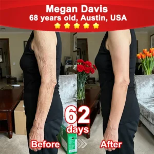 💖𝘾𝙑𝙎'𝙨 𝙊𝙣𝙡𝙞𝙣𝙚💖Croaie® Stem Cell–Powered NAD+ Activating Collagen Peptide Oral Solution |👩‍⚕️ (⭐ Visibly Lift Sagging Skin and Smooth Wrinkles — All From the Inside Out)🌵