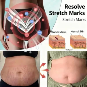 🎉 Limited-time offer – huge discount! 💰 Alisanda™ Self-regulating tourmaline shaping shorts with titanium fiber