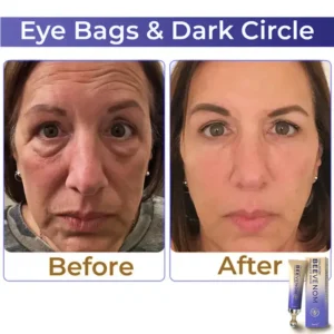 🐝 flysmus® Collagen+ Bee Venom Roller Eye Cream 🇺🇸 Made in USA