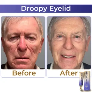 🐝 flysmus® Collagen+ Bee Venom Roller Eye Cream 🇺🇸 Made in USA