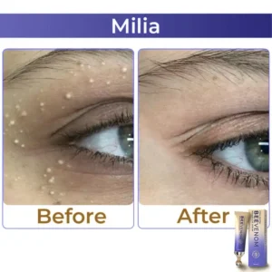 🐝 flysmus® Collagen+ Bee Venom Roller Eye Cream 🇺🇸 Made in USA