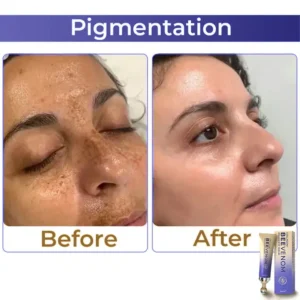 🐝 flysmus® Collagen+ Bee Venom Roller Eye Cream 🇺🇸 Made in USA