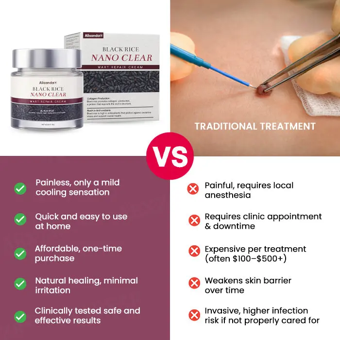 Alisanda® BlackRice Nano Clear Wart Repair Cream