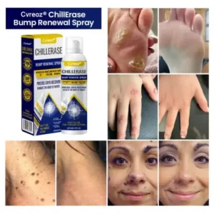 Cvreoz® ChillErase Bump Renewal Spray