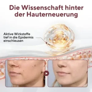 Cvreoz® KeraErase Dual-Action Erneuerungscreme