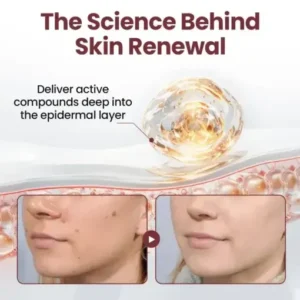 Cvreoz® OryzaClear Black Rice Botanical Keratin-Softening Cream