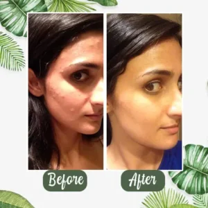 DIYSTAR™Natural Green Tea Clay  Stick– Clears Acne & Refines Pores🌿