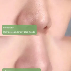 DIYSTAR™Natural Green Tea Clay  Stick– Clears Acne & Refines Pores🌿