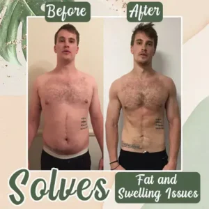 Diystar™ Detox & Slim Belly Patch — Daily Slimming Support for a Flatter, Cleaner Gut