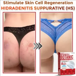 Juxek3345™ Removal Patch y (Copy)