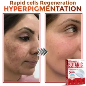 Juxekdd324™ Removal Patch: Gentle Microneedle Patches for Skin Tag & Mole Removal (Copy)