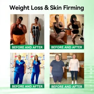 NATRAVOR® 𝑴𝒆𝒕𝒂𝒃𝒐𝒍𝒊𝒄 𝑵𝒂𝒏𝒐 𝑴𝒊𝒄𝒓𝒐𝒏𝒆𝒆𝒅𝒍𝒆 𝑷𝒂𝒕𝒄𝒉🇺🇸(𝐉𝐮𝐬𝐭 𝐨𝐧𝐜𝐞 𝐚 𝐝𝐚𝐲, 𝐯𝐢𝐬𝐢𝐛𝐥𝐞 𝐜𝐡𝐚𝐧𝐠𝐞𝐬 𝐢𝐧 𝟕 𝐝𝐚𝐲𝐬）𝘽𝙚𝙧𝙗𝙚𝙧𝙞𝙣𝙚 + 𝙈𝙤𝙧𝙞𝙣𝙜𝙖 𝙁𝙤𝙧𝙢𝙪𝙡𝙖 ✅ 𝐅𝐨𝐫 𝐨𝐛𝐞𝐬𝐢𝐭𝐲, 𝗟𝗼𝗼𝘀𝗲 𝘀𝗸𝗶𝗻,𝐝𝐢𝐚𝐛𝐞𝐭𝐞𝐬, 𝐬𝐥𝐞𝐞𝐩 𝐚𝐩𝐧𝐞𝐚, 𝐣𝐨𝐢𝐧𝐭 𝐢𝐬𝐬𝐮𝐞𝐬, 𝐚𝐧𝐝 𝐦𝐨𝐫𝐞 💥💥