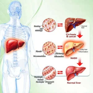 NATRAVOR® 𝑴𝒆𝒕𝒂𝒃𝒐𝒍𝒊𝒄 𝑵𝒂𝒏𝒐 𝑴𝒊𝒄𝒓𝒐𝒏𝒆𝒆𝒅𝒍𝒆 𝑷𝒂𝒕𝒄𝒉🇺🇸(𝐉𝐮𝐬𝐭 𝐨𝐧𝐜𝐞 𝐚 𝐝𝐚𝐲, 𝐯𝐢𝐬𝐢𝐛𝐥𝐞 𝐜𝐡𝐚𝐧𝐠𝐞𝐬 𝐢𝐧 𝟕 𝐝𝐚𝐲𝐬）𝘽𝙚𝙧𝙗𝙚𝙧𝙞𝙣𝙚 + 𝙈𝙤𝙧𝙞𝙣𝙜𝙖 𝙁𝙤𝙧𝙢𝙪𝙡𝙖 ✅ 𝐅𝐨𝐫 𝐨𝐛𝐞𝐬𝐢𝐭𝐲, 𝗟𝗼𝗼𝘀𝗲 𝘀𝗸𝗶𝗻,𝐝𝐢𝐚𝐛𝐞𝐭𝐞𝐬, 𝐬𝐥𝐞𝐞𝐩 𝐚𝐩𝐧𝐞𝐚, 𝐣𝐨𝐢𝐧𝐭 𝐢𝐬𝐬𝐮𝐞𝐬, 𝐚𝐧𝐝 𝐦𝐨𝐫𝐞 💥💥